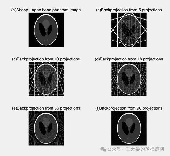 #108 CT重建的3D深度学习技术——深度学习图像重建算法分类2 #108 CT重建的3D深度学习技术——深度学习图像重建算法分类2